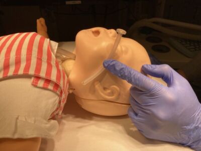 NPA being sized along the side of the face from the tip of the nostril to the tragus.