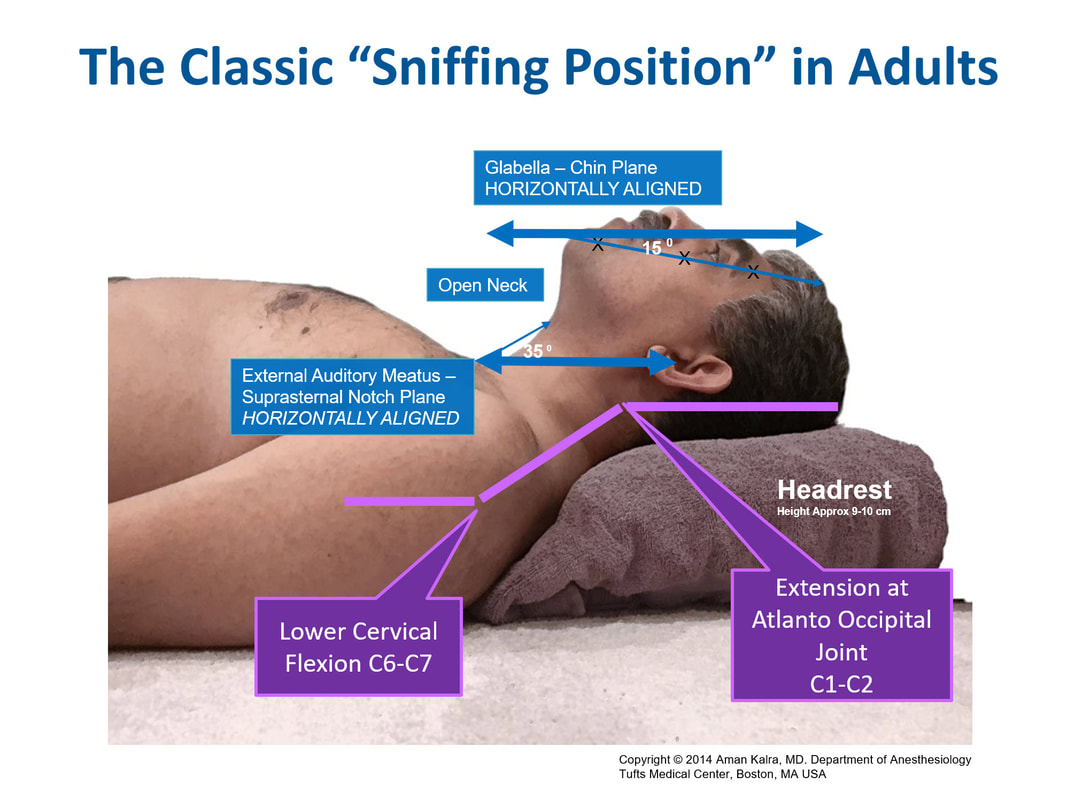 Adult in classic sniffing position with head elevated on a pillow.